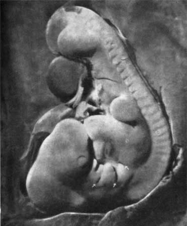 Трагедия диких животных - pic_42.jpg