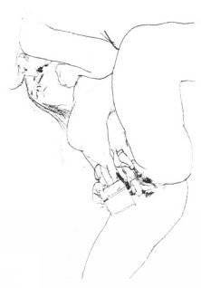 Сексуальная терапия - pic_13.jpg