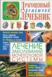 Лечение заболеваний мочеполовой системы - Мирошниченко Светлана Анатольевна