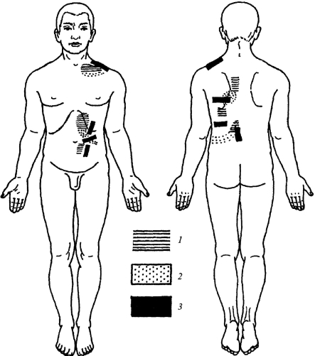 Всё про массаж - i_170.jpg