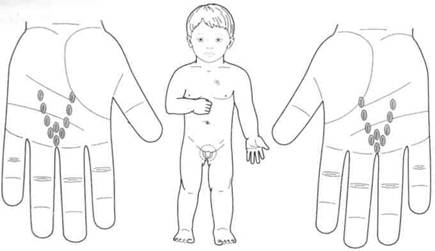 Су Джок семянотерапия - any2fbimgloader107.jpeg