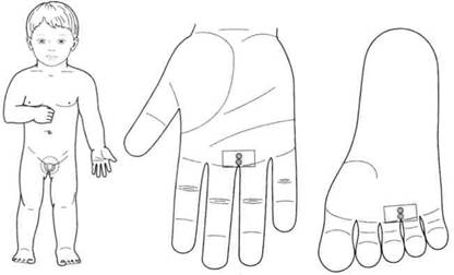 Су Джок семянотерапия - any2fbimgloader110.jpeg