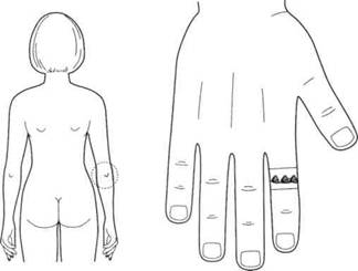 Су Джок семянотерапия - any2fbimgloader114.jpeg