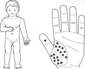 Су Джок семянотерапия - any2fbimgloader115.jpeg