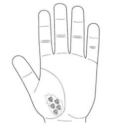 Су Джок семянотерапия - any2fbimgloader45.jpeg