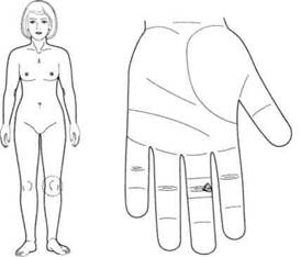 Су Джок семянотерапия - any2fbimgloader133.jpeg