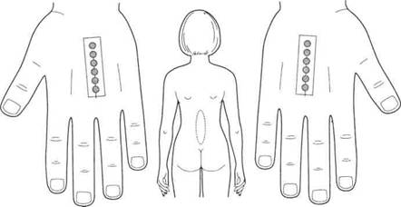 Су Джок семянотерапия - any2fbimgloader135.jpeg