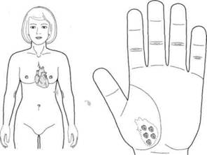 Су Джок семянотерапия - any2fbimgloader136.jpeg